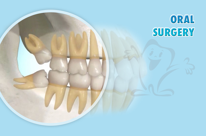 ORAL-SURGERY